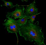 Cells with stained ER, DNA and Microtubules